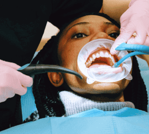 Philadelphia has dental cleanings - Preventive Oral Care Strategies - Root Canal vs. Tooth Extraction